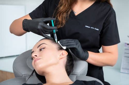 Мезотерапия при косопад