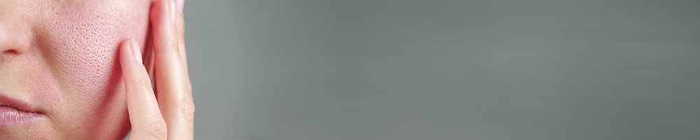 разширени пори