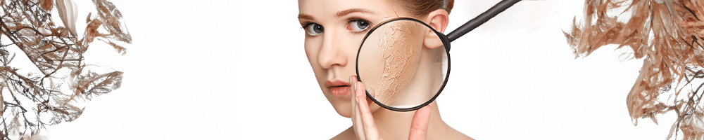 Дехидратирана Кожа