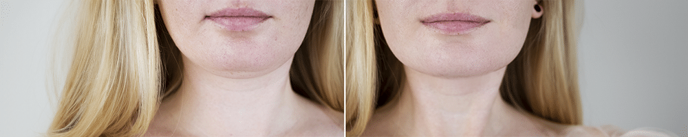 Нарушен контур