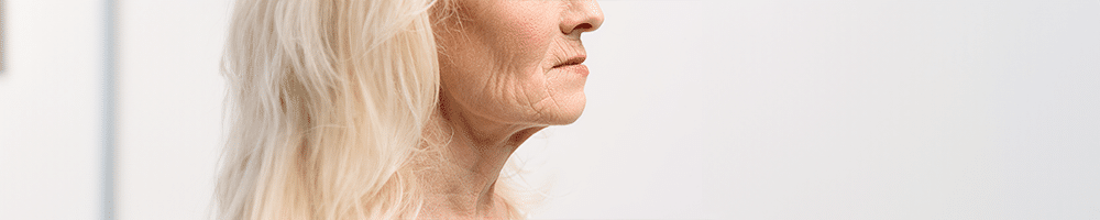 Загуба на обем