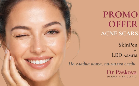 ACNE SCARS