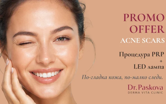 ACNE SCARS